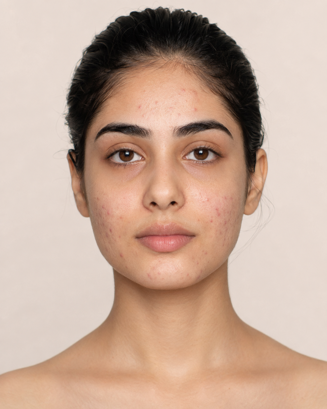 Skin before using Glo2Go
