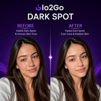 AfterGlow 50 GM For All Skin Types